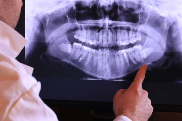 Best Broken Tooth Emergency  in Woodbourne, PA