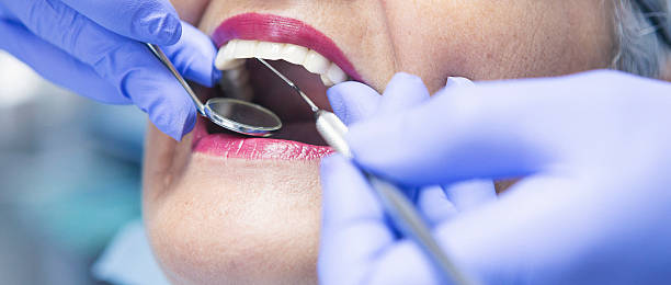 Best Chipped Tooth Repair Near Me  in Woodbourne, PA